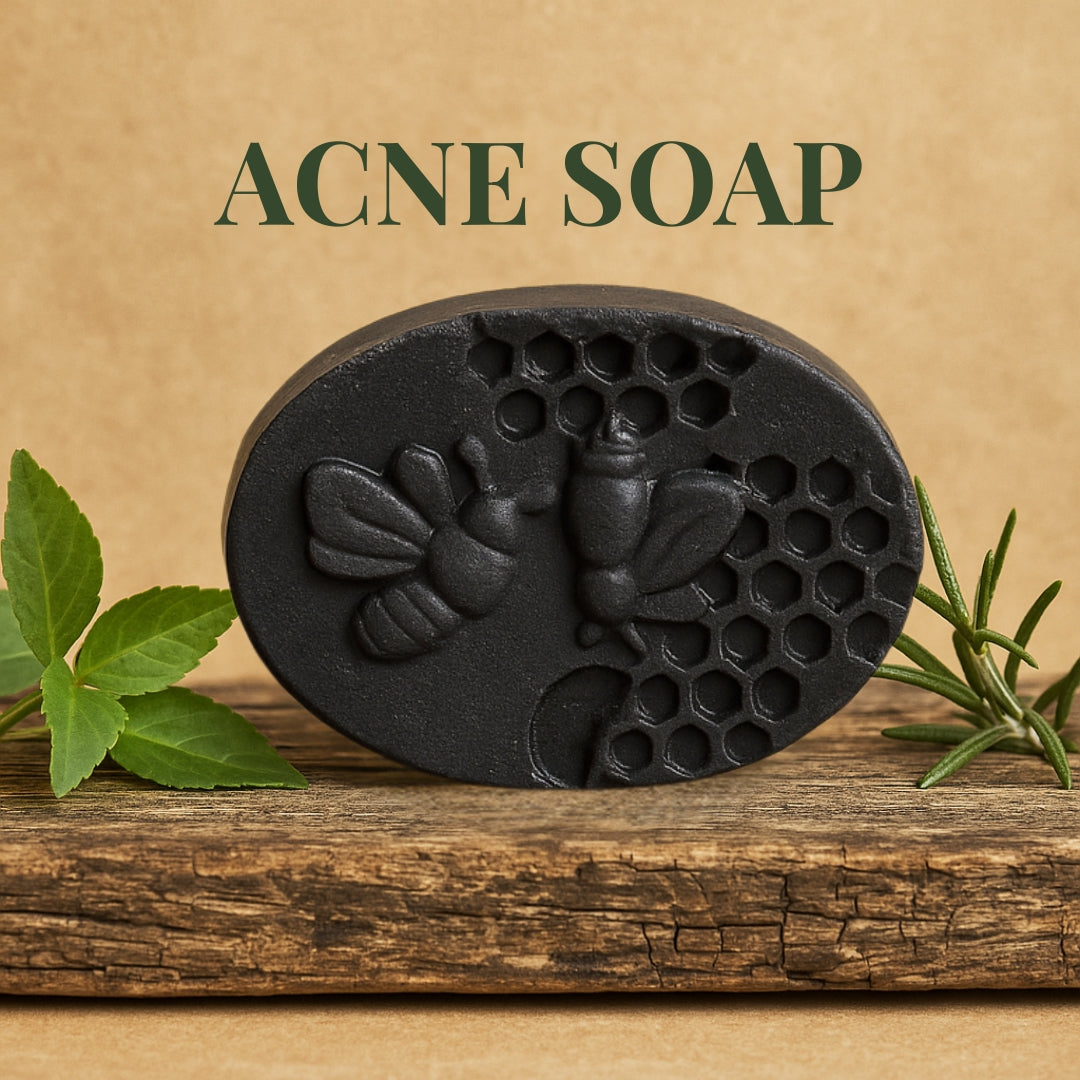 Acne Soap
