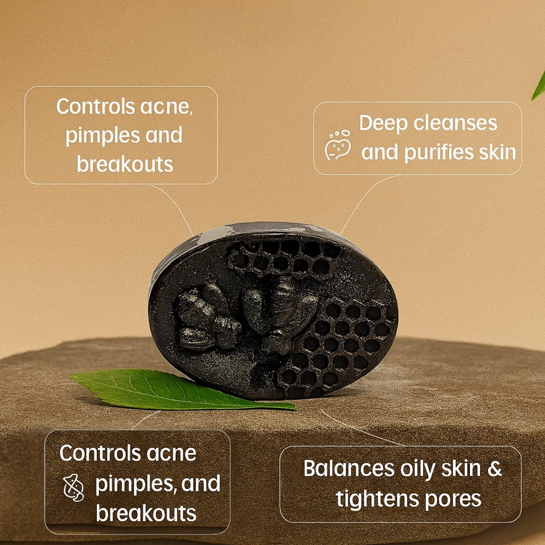 Acne Soap