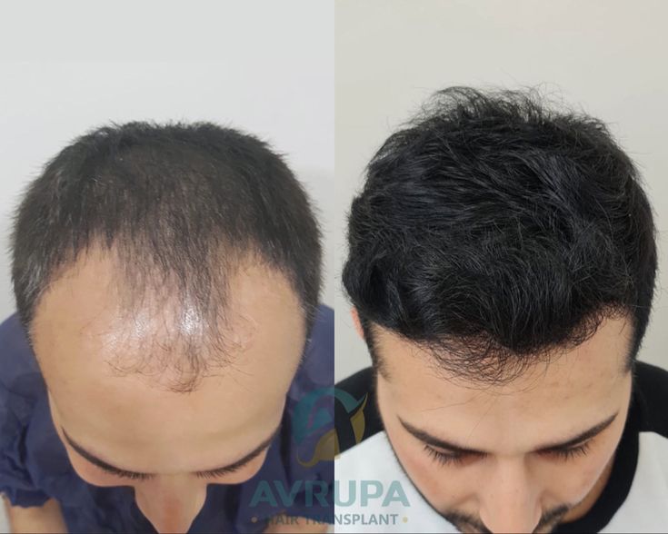 Organic Hair Oil